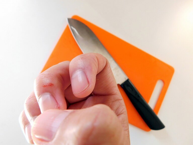 外科・脂肪腫の手術について